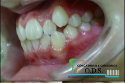 Clinica Dental & Ortodoncia O.D.S/ Dr. Eric Romero Ortodoncista de niños y adultos